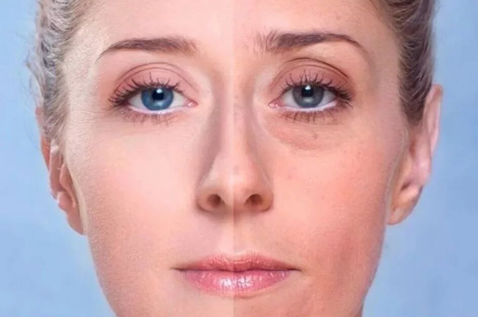 Zurück unter die Augen